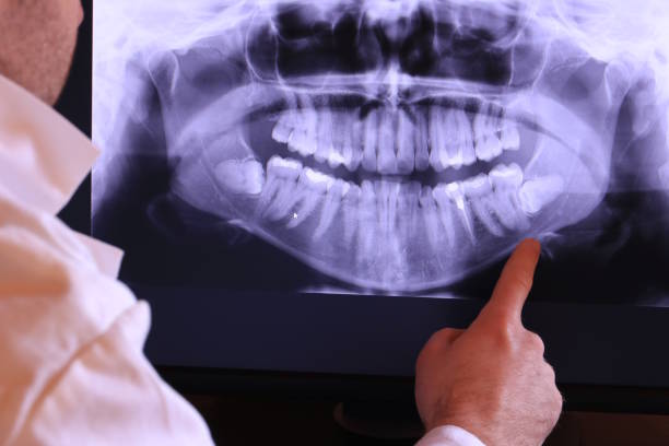 Best Tooth Pain Emergency Relief  in Georgetown, CA