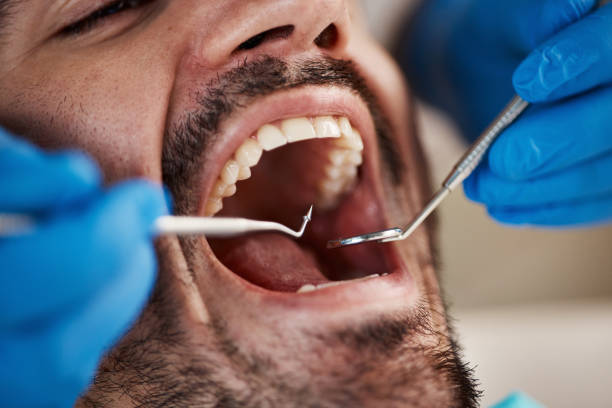 Best Teeth Whitening  in Georgetown, CA