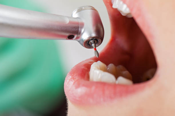 Best Dentist Open on Weekends  in Georgetown, CA